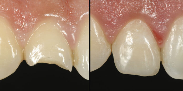 Harmonize™ restorative case study